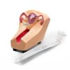 IUD Insertion Model: Supporting Hands-On Clinical Training
